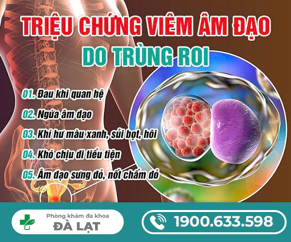 Hình ảnh minh họa